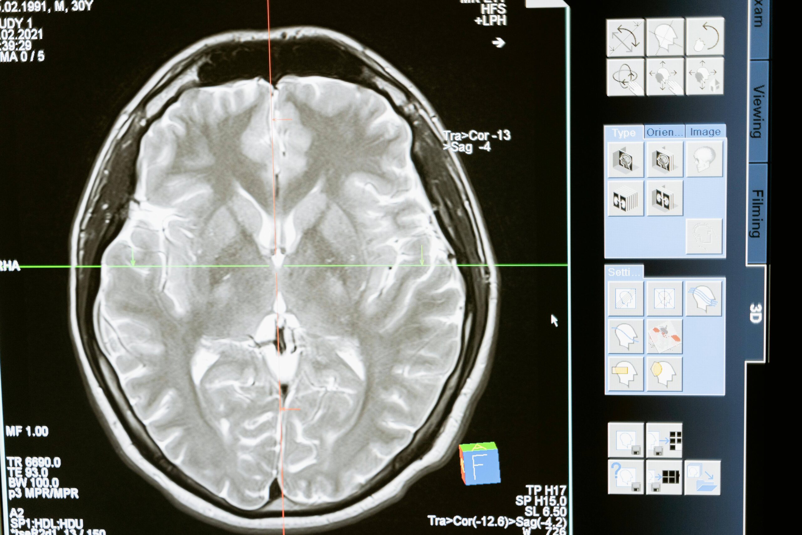Les mécanismes de résistance : Pourquoi ton cerveau résiste à la guérison